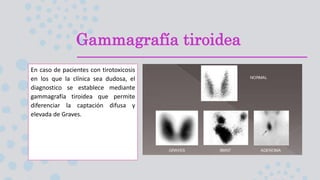 Gammagrafía tiroidea
En caso de pacientes con tirotoxicosis
en los que la clínica sea dudosa, el
diagnostico se establece mediante
gammagrafía tiroidea que permite
diferenciar la captación difusa y
elevada de Graves.
 