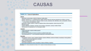 CAUSAS
 