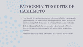 PATOGENIA: TIROIDITIS DE
HASHIMOTO
– En la tiroiditis de Hashimoto existe una infiltración linfocítica marcada de la
glándula tiroides con formación de centros germinales, atrofia de folículos
tiroideos acompañada de ausencia de coloide y fibrosis leve o moderada.
– En la tiroiditis atrófica, la fibrosis es mucho más extensa, la infiltración
linfocítica es menos pronunciada y los folículos tiroideos faltan casi por
completo.
– Probablemente represente el estadio final de la tiroiditis de Hashimoto
 