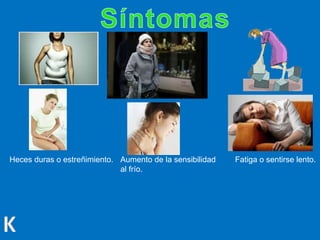 Heces duras o estreñimiento. Aumento de la sensibilidad
al frío.
Fatiga o sentirse lento.
 