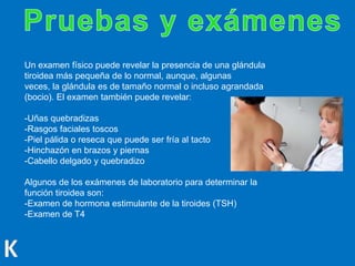 Un examen físico puede revelar la presencia de una glándula
tiroidea más pequeña de lo normal, aunque, algunas
veces, la glándula es de tamaño normal o incluso agrandada
(bocio). El examen también puede revelar:
-Uñas quebradizas
-Rasgos faciales toscos
-Piel pálida o reseca que puede ser fría al tacto
-Hinchazón en brazos y piernas
-Cabello delgado y quebradizo
Algunos de los exámenes de laboratorio para determinar la
función tiroidea son:
-Examen de hormona estimulante de la tiroides (TSH)
-Examen de T4
 