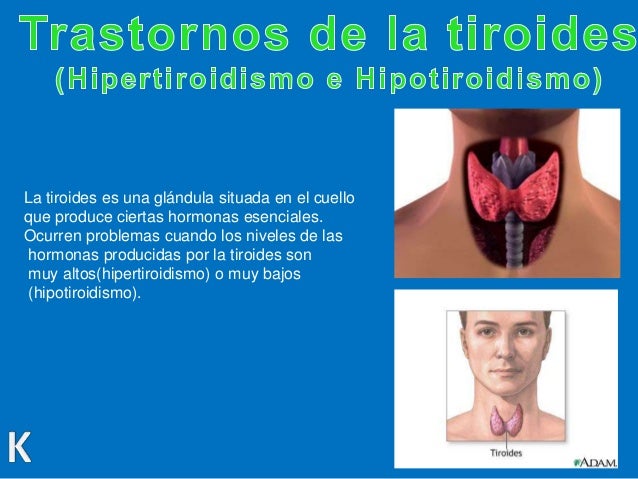 El traje la sauna para el adelgazamiento como usar
