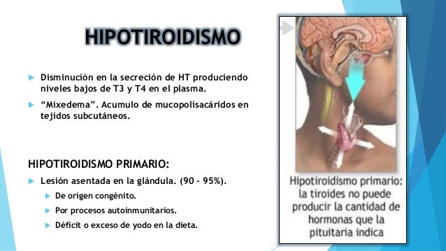 Los ejercicios para el aumento del volumen del busto