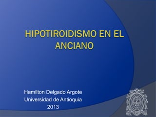 Hamilton Delgado Argote
Universidad de Antioquia
2013
 