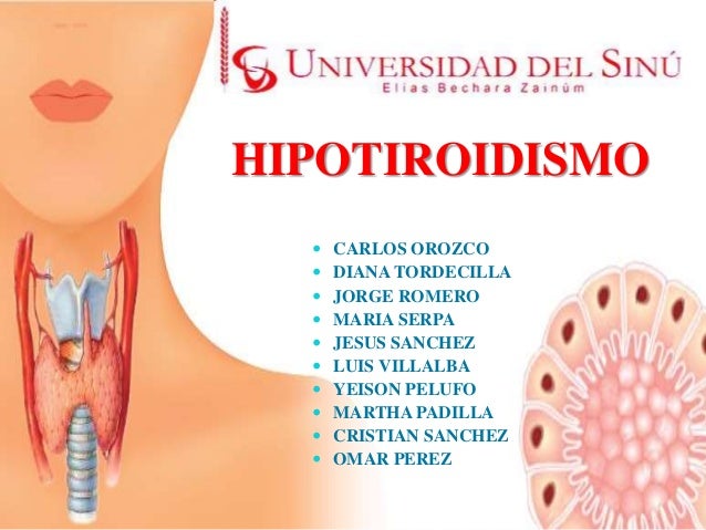 Hipotiroidismo