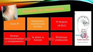 Causa #1
Destruccion
autoimmune
tirocitos
 Mujeres
(4-10:1)
Forman
inmunocomplejos
y complementos
Se altera su
funcion
Disminuye
produccion
 