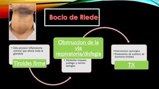• 2do proceso inflamatoria
cronico que afecta toda la
glandula
Tiroides firme
• Molestias traquea,
esofago y nervio
laringeo
Obstruccion de la
via
respiratoria/disfagia
•Intervencion quirurgica
•Tratamiento de susticion de
hormona tiroidea
TX
 