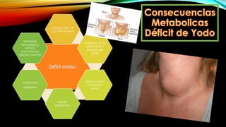 Deficit cronico
producción T3
y T4 disminuyen
aumento en la
eliminación
tiroidea de
yodo
disminuye la
excreción
renal
bocio
endémico
cretinismo
endemico
deterioro
neurológico,
retraso
crecimiento,
retraso mental
 