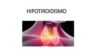 HIPOTIROIDISMO
 