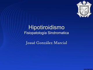 Hipotiroidismo
Fisiopatología Sindromatica

 Josué González Marcial
 