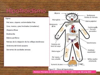 Harrison Principios de la medicina interna 17 edicion cap 335 pag 2231
 