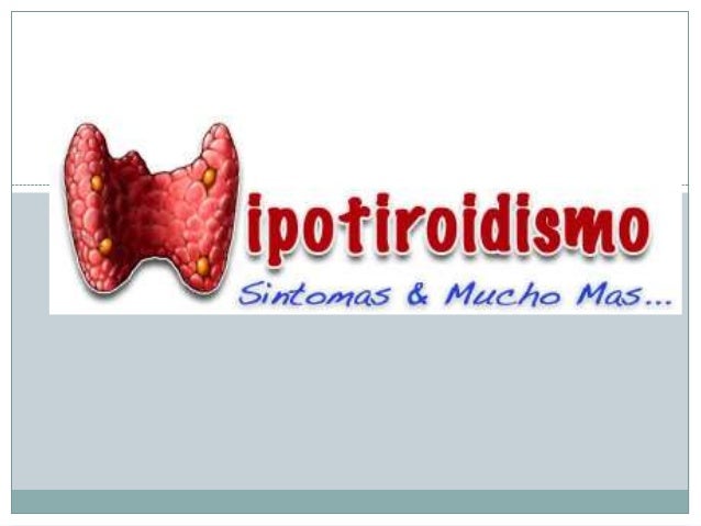 hipertiroidismo e hipotiroidismo ppt 2016 05-31)hipotiroidismo(doc).