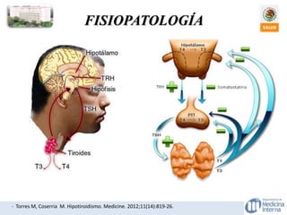 - Torres M, Coserria M. Hipotiroidismo. Medicine. 2012;11(14):819-26.
FISIOPATOLOGÍA
 