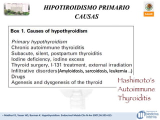 HIPOTIROIDISMO PRIMARIO
CAUSAS
- Madhuri D, Yasser HO, Burman K. Hypothyroidism. Endocrinol Metab Clin N Am 2007;36:595-615.
(Amyloidosis, sarcoidosis, leukemia ..)
 