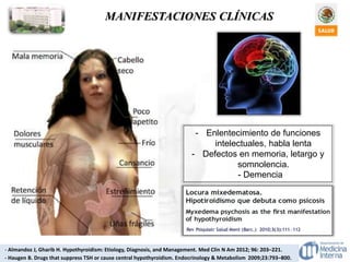 MANIFESTACIONES CLÍNICAS
- Almandoz J, Gharib H. Hypothyroidism: Etiology, Diagnosis, and Management. Med Clin N Am 2012; 96: 203–221.
- Haugen B. Drugs that suppress TSH or cause central hypothyroidism. Endocrinology & Metabolism 2009;23:793–800.
- Enlentecimiento de funciones
intelectuales, habla lenta
- Defectos en memoria, letargo y
somnolencia.
- Demencia
 