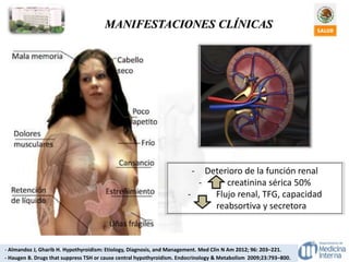 MANIFESTACIONES CLÍNICAS
- Almandoz J, Gharib H. Hypothyroidism: Etiology, Diagnosis, and Management. Med Clin N Am 2012; 96: 203–221.
- Haugen B. Drugs that suppress TSH or cause central hypothyroidism. Endocrinology & Metabolism 2009;23:793–800.
- Deterioro de la función renal
- creatinina sérica 50%
- Flujo renal, TFG, capacidad
reabsortiva y secretora
 