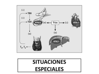 SITUACIONES
ESPECIALES
 