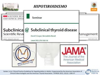 Garber J et al. Clinical Practice Guidelines for Hypothyroidism in Adults: Cosponsored by the American Association of
Clinical Endocrinologists and the American Thyroid Association. THYROID 2012; 22(12): 1200-37.
HIPOTIROIDISMO
 