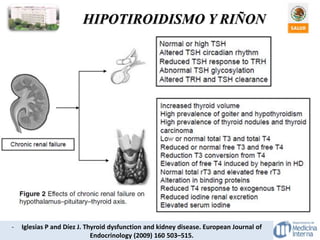 HIPOTIROIDISMO Y RIÑON
- Iglesias P and Díez J. Thyroid dysfunction and kidney disease. European Journal of
Endocrinology (2009) 160 503–515.
 