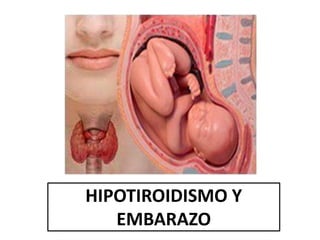 HIPOTIROIDISMO Y
EMBARAZO
 