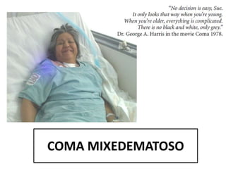 COMA MIXEDEMATOSO
 