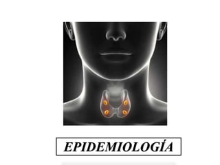 EPIDEMIOLOGÍA
 