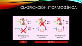 CLASIFICACIÓN ETIOPATOGÉNICA
99% CENTRAL
 
