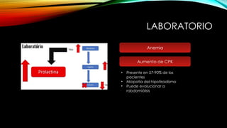 LABORATORIO
Anemia
Aumento de CPK
• Presente en 57-90% de los
pacientes
• Miopatía del hipotiroidismo
• Puede evolucionar a
rabdomiólisis
 