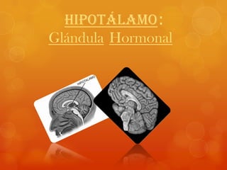 Hipotálamo:
Glándula Hormonal
 