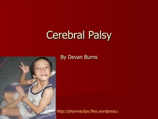 Cerebral Palsy By Devan Burns http://pharmaclips.files.wordpress.com/2009/12/cerebral-palsy.jpg   
