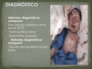 Métodos diagnósticos anteparto: Frecuencia cardiaca fetal basal (FCF) Perfil biofísico fetal Flujometría doppler     Métodos diagnósticos intraparto: Estudio del equilibrio ácido- base 