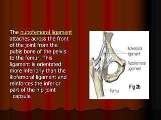 pubofemoral ligamentThe
attaches across the front
of the joint from the
pubis bone of the pelvis
to the femur. This
ligament is orientated
more inferiorly than the
iliofemoral ligament and
reinforces the inferior
part of the hip joint
capsule
 
