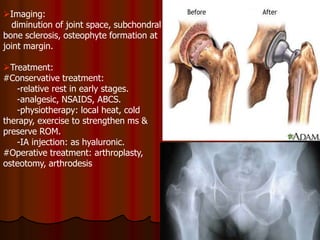 Imaging:
diminution of joint space, subchondral
bone sclerosis, osteophyte formation at
joint margin.
Treatment:
#Conservative treatment:
-relative rest in early stages.
-analgesic, NSAIDS, ABCS.
-physiotherapy: local heat, cold
therapy, exercise to strengthen ms &
preserve ROM.
-IA injection: as hyaluronic.
#Operative treatment: arthroplasty,
osteotomy, arthrodesis
 
