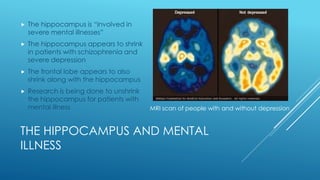 THE HIPPOCAMPUS AND MENTAL
ILLNESS
 The hippocampus is “involved in
severe mental illnesses”
 The hippocampus appears to shrink
in patients with schizophrenia and
severe depression
 The frontal lobe appears to also
shrink along with the hippocampus
 Research is being done to unshrink
the hippocampus for patients with
mental illness MRI scan of people with and without depression
 