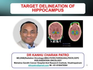 TARGET DELINEATION OF
HIPPOCAMPUS
DR KANHU CHARAN PATRO
MD,DNB(Radiation Oncology),MBA,FICRO,FAROI(USA),PDCR,CEPC
HOD,RADIATION ONCOLOGY
Mahatma Gandhi Cancer Hospital And Research Institute, Visakhapatnam
drkcpatro@gmail.com /M- +91-9160470564 1
 
