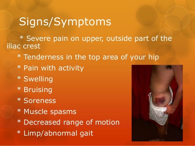 What is hip pain a symptom of?