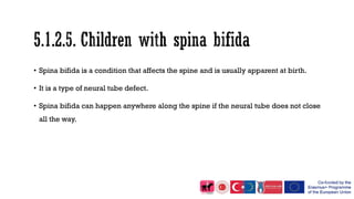 • Spina bifida is a condition that affects the spine and is usually apparent at birth.
• It is a type of neural tube defect.
• Spina bifida can happen anywhere along the spine if the neural tube does not close
all the way.
 