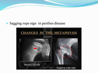 Hip PT Assessment.pptx