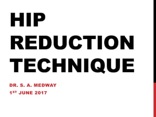 HIP
REDUCTION
TECHNIQUE
DR. S. A. MEDWAY
1ST JUNE 2017
 