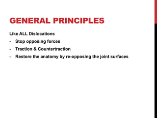 GENERAL PRINCIPLES
Like ALL Dislocations
- Stop opposing forces
- Traction & Countertraction
- Restore the anatomy by re-opposing the joint surfaces
 