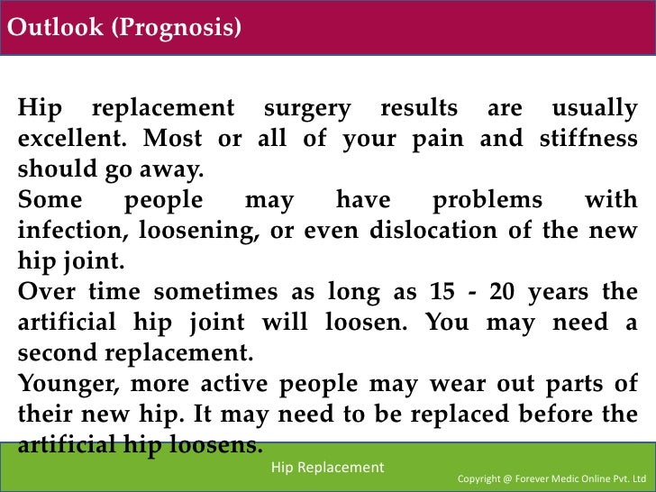 Hip Replacement Bilateral surgery & Treatment MedicYatra