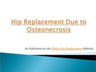As Published on the DePuy Hip Replacement Website
 