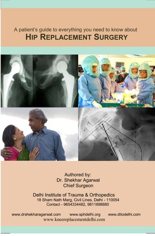 A patient’s guide to everything you need to know about
HIP REPLACEMENT SURGERY
Authored by:
Dr. Shekhar Agarwal
Chief Surgeon
Delhi Institute of Trauma & Orthopedics
18 Sham Nath Marg, Civil Lines, Delhi - 110054
Contact - 9654334482, 9811898880
www.drshekharagarwal.com www.sphdelhi.org www.ditodelhi.com
www.kneereplacementdelhi.com
 