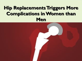 Hip ReplacementsTriggers MoreHip ReplacementsTriggers More
Complications inWomen thanComplications inWomen than
MenMen
 