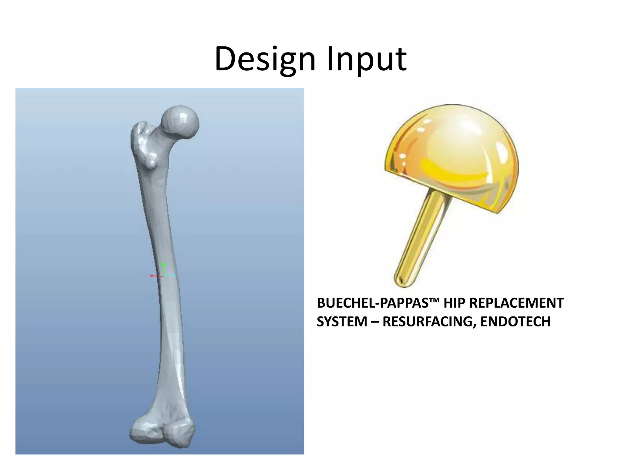 Design InputBUECHEL-PAPPAS™ HIP REPLACEMENT SYSTEM – RESURFACING, ENDOTECH