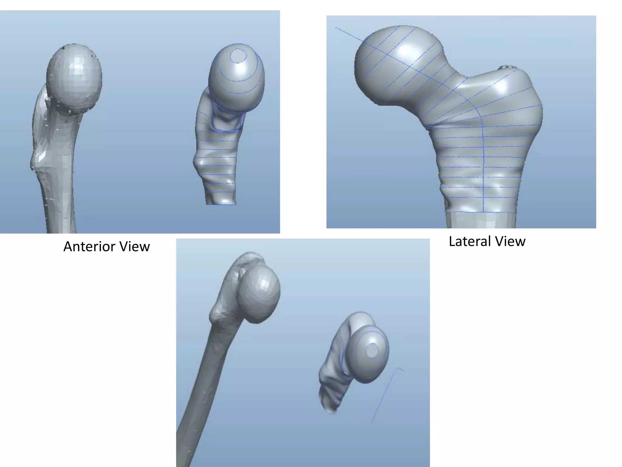 Lateral ViewAnterior View