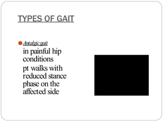 TYPES OF GAIT
●Antalgicgait
in painful hip
conditions
pt walks with
reduced stance
phase on the
affected side
 