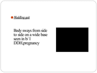 ●W
addlinggait
Body sways from side
to side on awide base
seen in b/ l
DDH,pregnancy
 