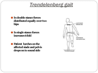 Trendelenberg gait
● Indoublestanceforces
distributedequally overtwo
hips
● Insinglestanceforces
increases6fold
● Patient lurchesonthe
affectedsiadeandpelvis
dropsontosoundside
 