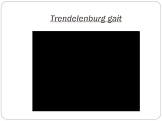 Trendelenburg gait
 
